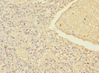 MRRF Antibody