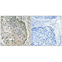 MRRF Antibody