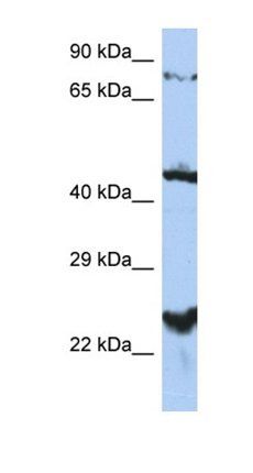 MRS2 antibody