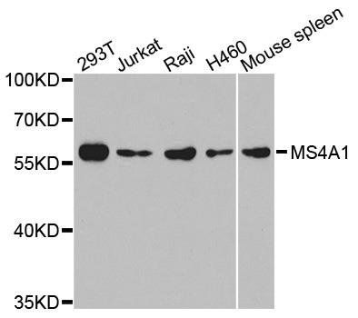 MS4A1 antibody