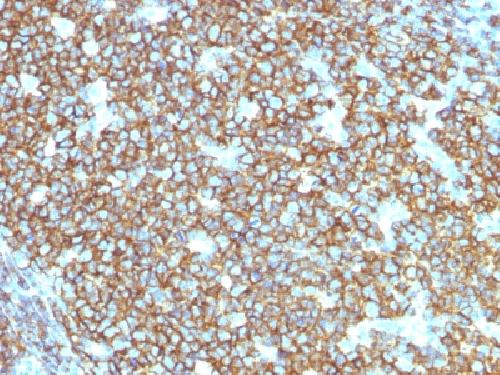 Recombinant CD20/ MS4A1 (B-Cell Marker) Antibody
