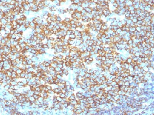 Recombinant CD20 / MS4A1 (B-Cell Marker) Antibody