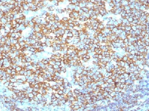 MS4A1 antibody