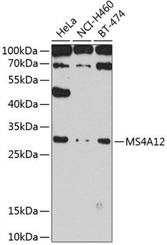 MS4A12 antibody