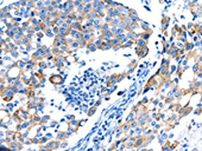 POMC Antibody