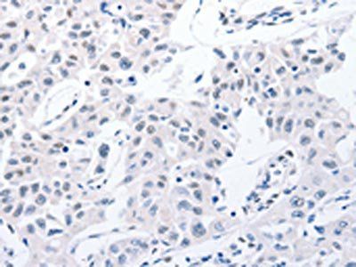 MSH Alpha antibody