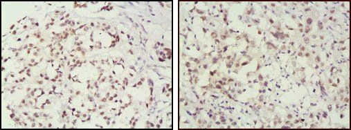 MSH2 Antibody
