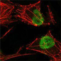 MSH2 Antibody