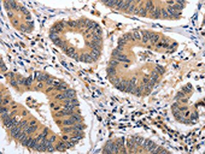MSH3 Antibody
