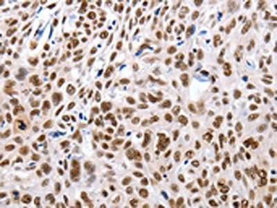 MSH3 Antibody