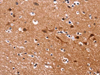 MSH4 Antibody