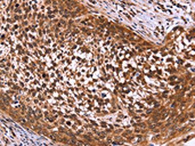 MSH4 Antibody