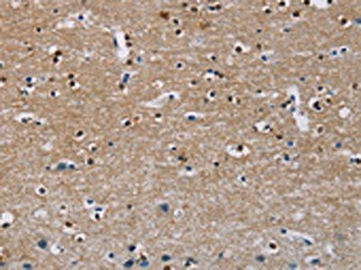 MSH5 Antibody