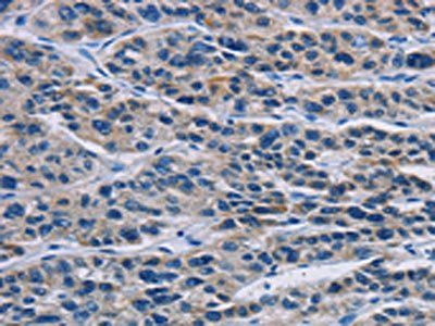 MSH5 Antibody