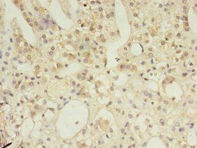 MSH6 Antibody