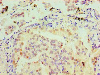 MSH6 Monoclonal Antibody