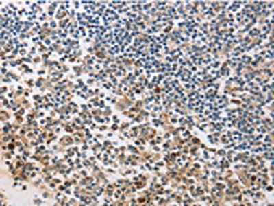 MSH6 antibody