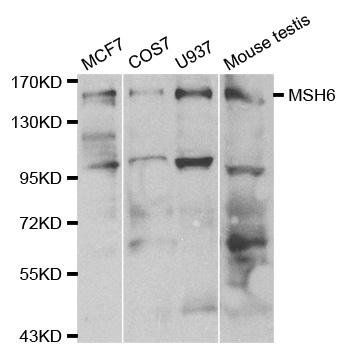 MSH6 antibody