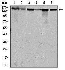 MSH6 Antibody