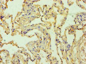 MSLN Antibody