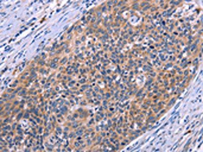 MSMO1 antibody