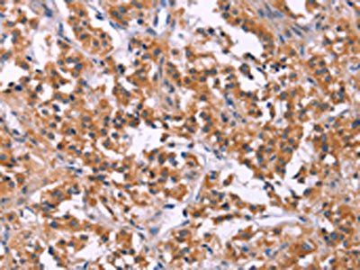 MSMO1 Antibody