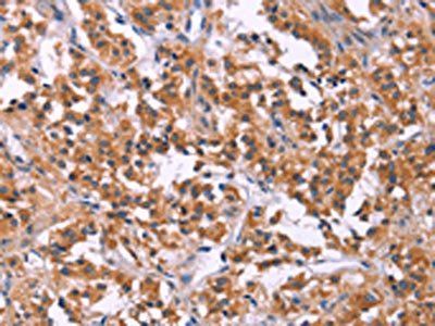 MSMO1 antibody