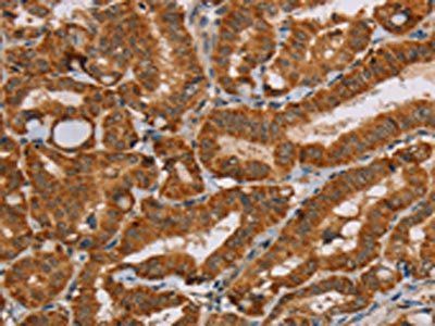 MSR1 Antibody