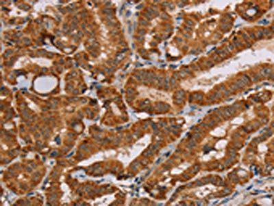 MSR1 antibody