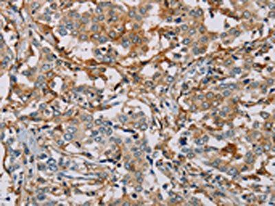 MSR1 Antibody
