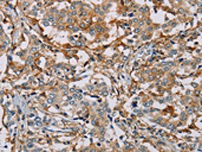 MSR1 antibody