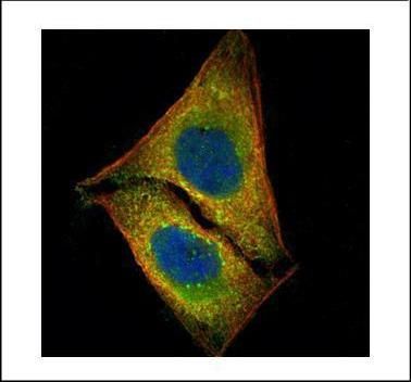 serine/threonine kinase 4 Antibody