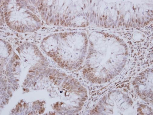 MST3 Rabbit Polyclonal Antibody