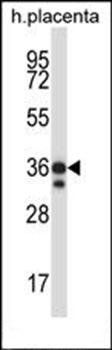 Mst4 antibody