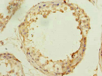 MSTO1 antibody