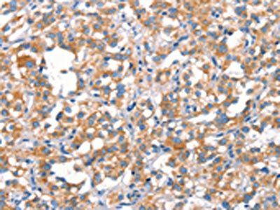 MT-CYB antibody