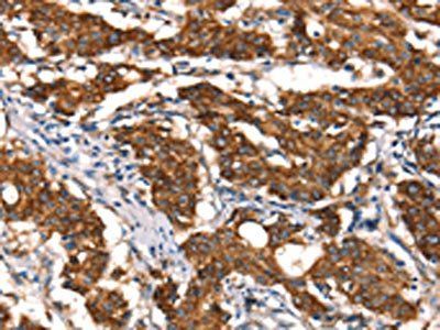 MT-CYB Antibody
