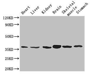 MT-ND1 Antibody