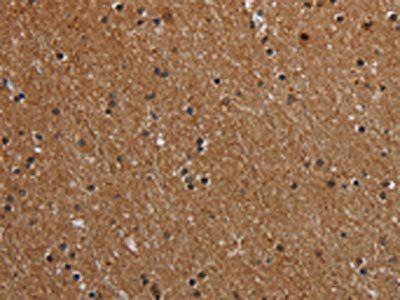 MT-ND1 Antibody
