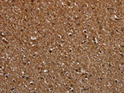 MT-ND1 Antibody