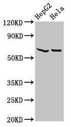 MT-ND5 Antibody