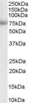 Goat anti-MTA1 Antibody