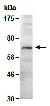 MTA2 (C) Antibody, Rabbit Polyclonal