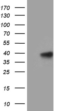 MTA3 Antibody