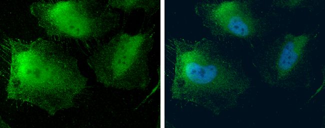 MTAP antibody [N1C3]