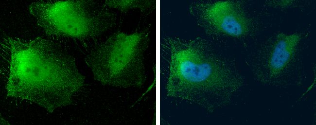 MTAP antibody