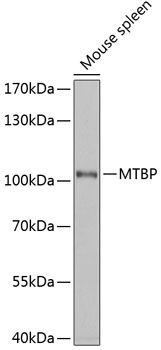 MTBP antibody