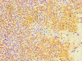 MTDH Antibody