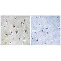 MTERF1 Antibody