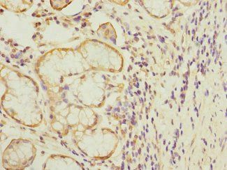 MTERF3 Antibody